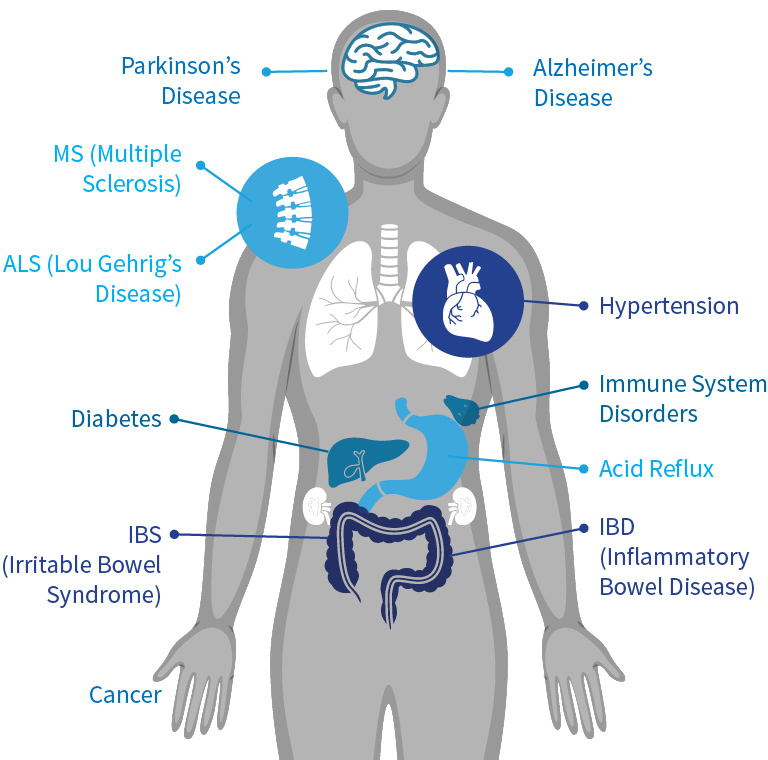 Internal Health | Ixcela